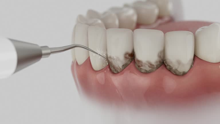 Reliable Dental contractor in Lone Pine, CA by Smile Center Dentistry